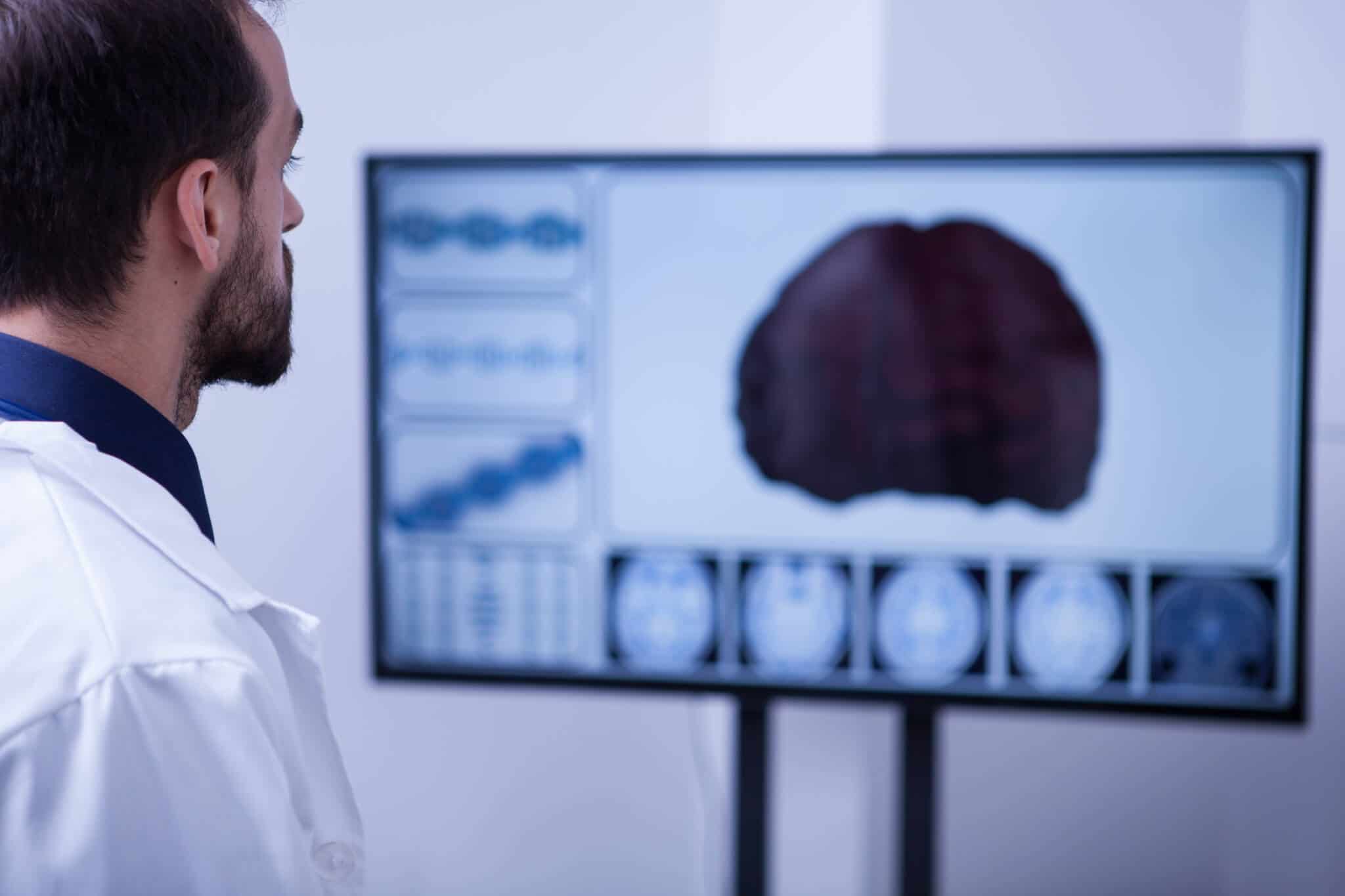 médico a olhar para imagem de cérebro