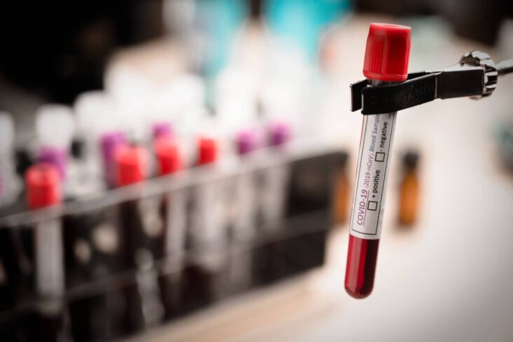 Tubo com uma amostra de sangue para realização de análises